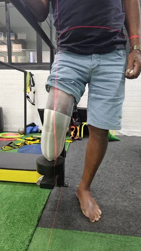 Prótese sendo alinhada com guia de laser