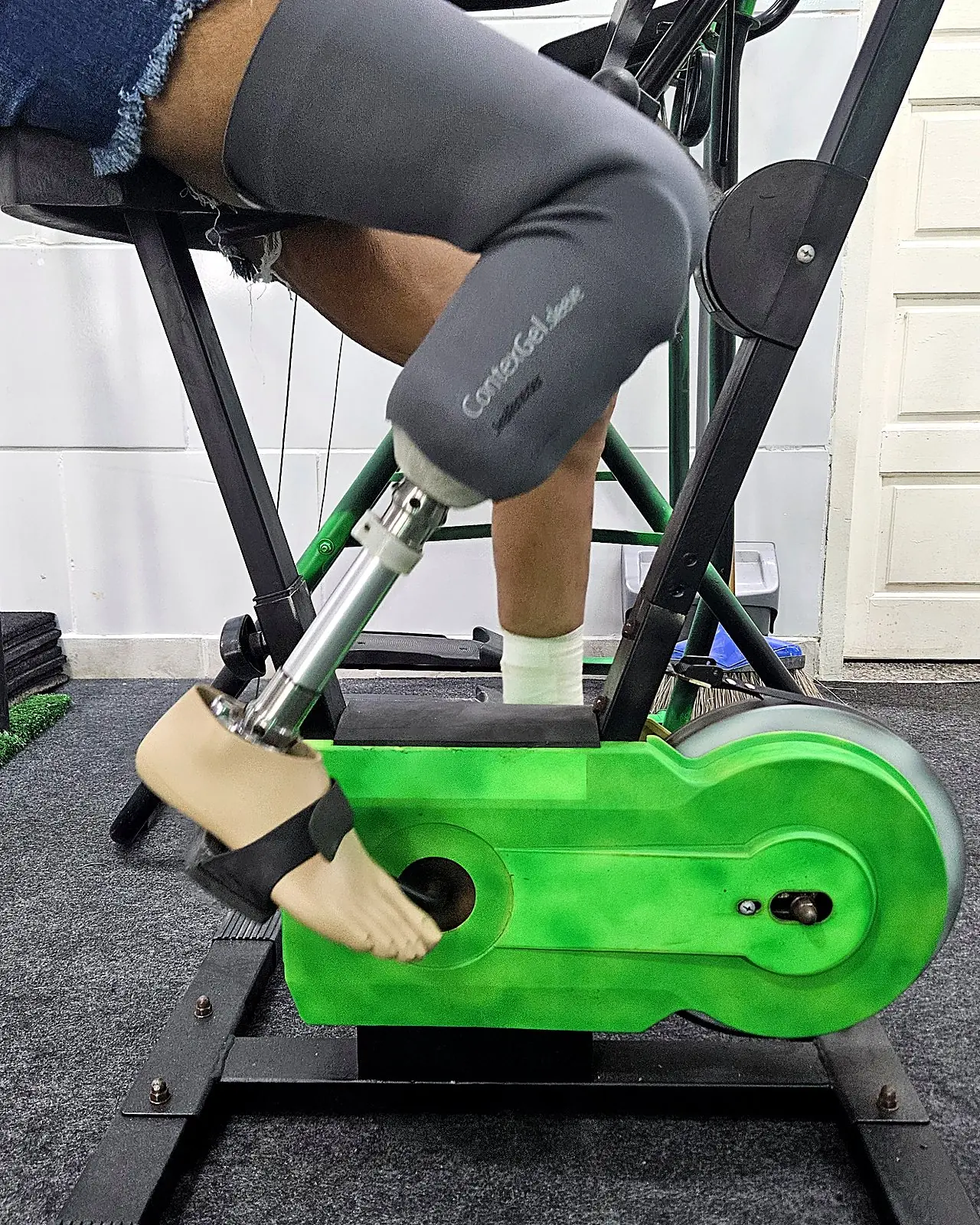 Paciente com prótese transfemoral pedalando na bicicleta de treino